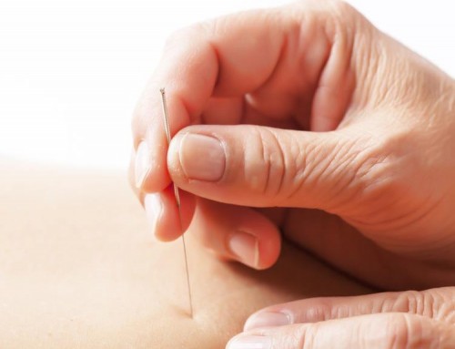 Neu bei uns: Dry Needling