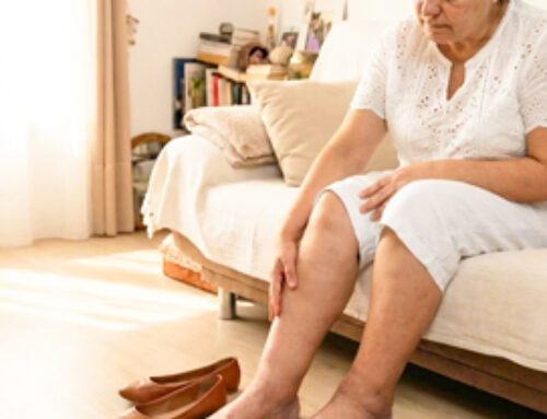 Geschwollene Beine ≠ automatisch ein Lymphödem