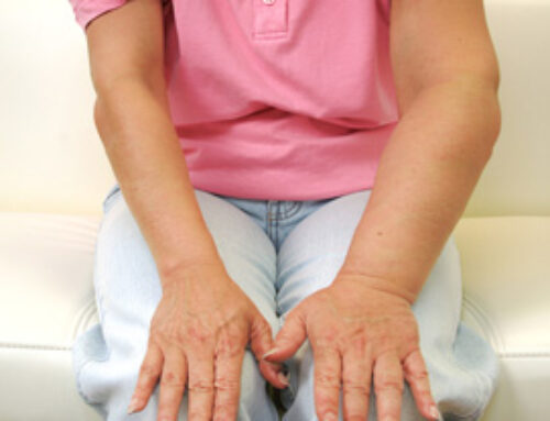 Manuelle Lymphdrainage nach Brustkrebsoperation